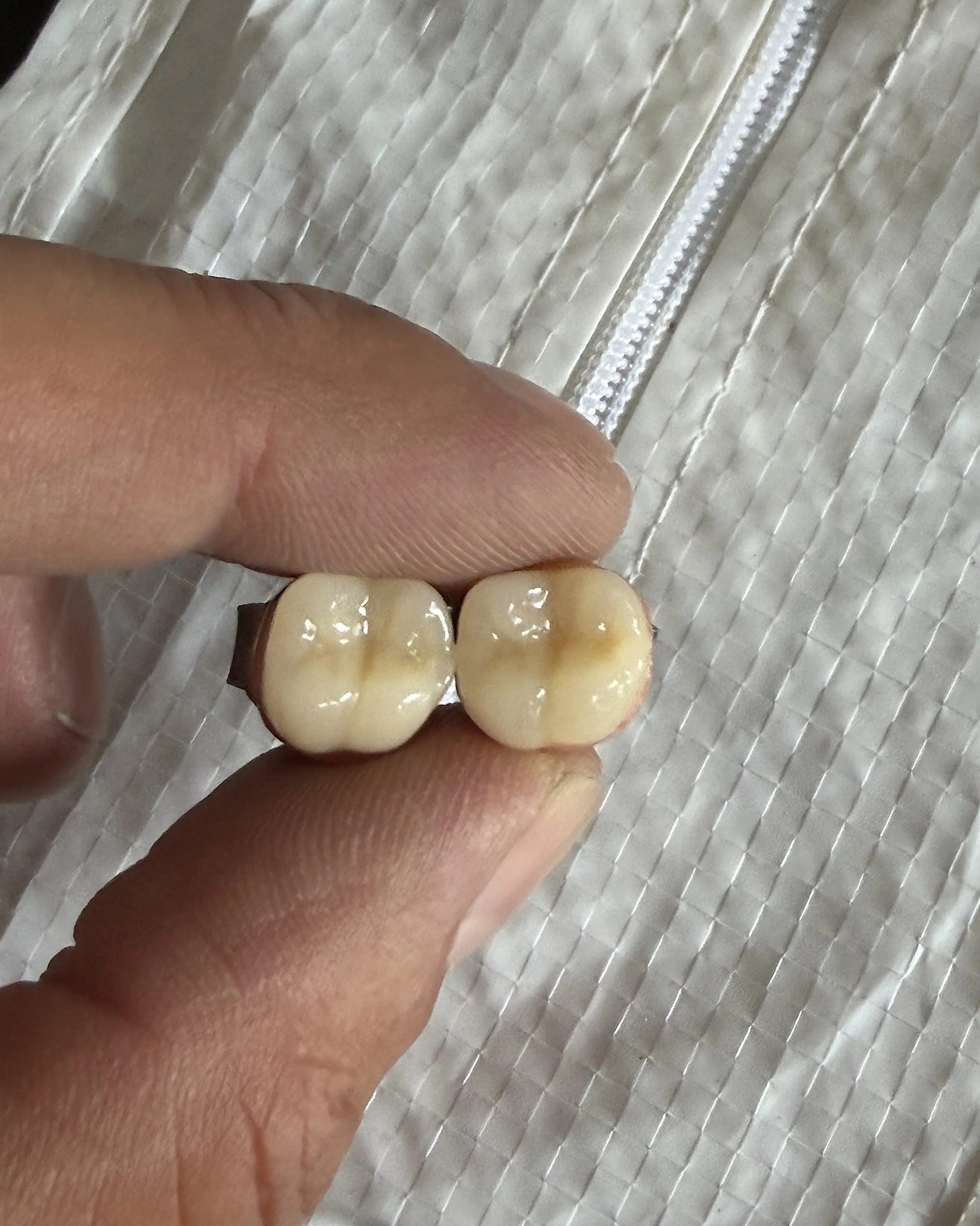 CAROL CHRISTIAN POELL'S TEETH EARRINGS RESURFACE ON GRAILED (image 4)
